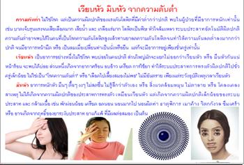 ใบความรู้ 17 เวียนหัว จากความดันต่ำ.JPG