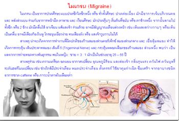 ใบความรู้ 13 ไมเกรน.JPG