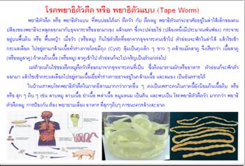 ใบความรู้ 11 พยาธิตัวตืด.JPG