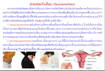 ใบความรู้ 7 ปวดประจำเดือน.JPG