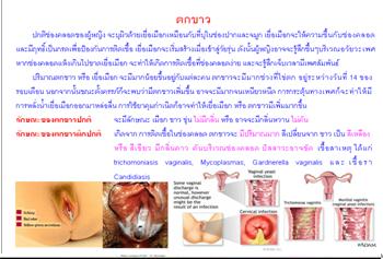 ใบความรู้ 5 ตกขาว.JPG