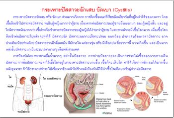 ใบความรู้ 3 กระเพาะปัสสาวะอักเสบ.JPG