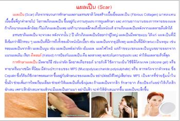 ใบความรู้ 29 แผลเป็น.JPG