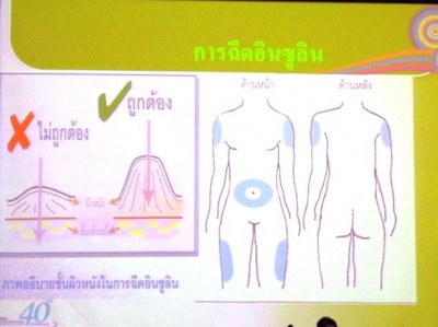 ประชุมวิชาการเภสัชจุฬา 22.JPG