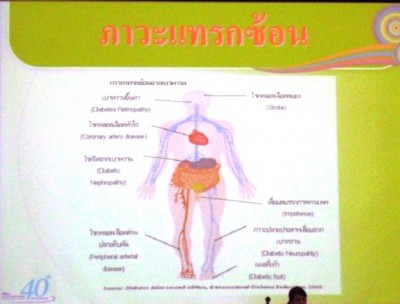 ประชุมวิชาการเภสัชจุฬา 09.JPG