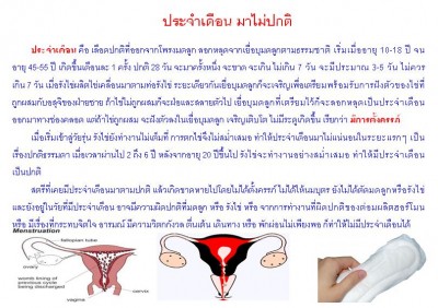 ใบความรู้ 33 ประจำเดือนมาไม่ปกติ.JPG