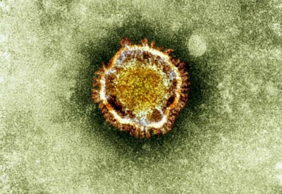 new novel coronavirus.jpg (101 KiB) เปิดดู 18595 ครั้ง new novel coronavirus.jpg